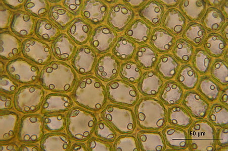 microscopic view of green and white cells thumbnail