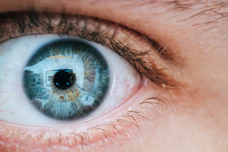 Person With Teal and Yellow Left Eye thumbnail