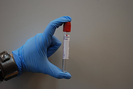 person holding clear glass test tube thumbnail