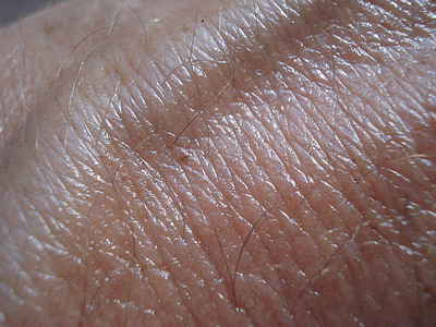 person's skin condition thumbnail