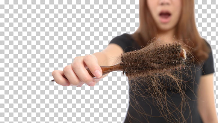 Management Of Hair Loss Hair Transplantation Human Hair Growth