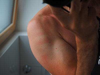 person's right hand thumbnail