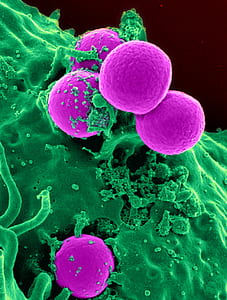 purple and green micro bacteria thumbnail