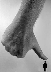 grayscale photo of human thumb thumbnail