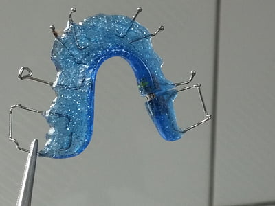 blue and silver retainer thumbnail