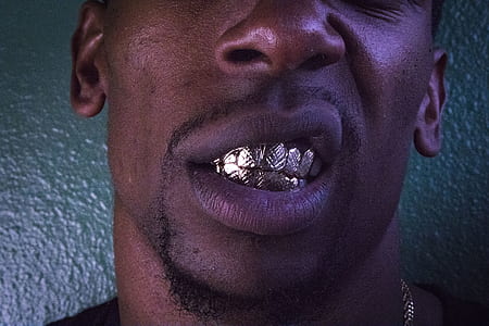 man with dental grillz thumbnail