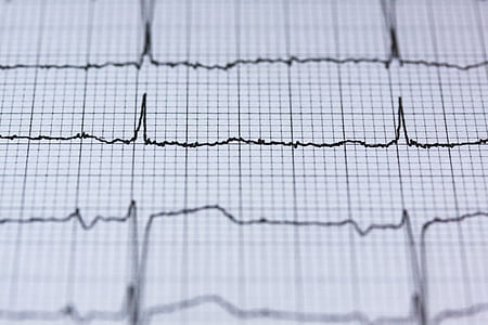 heart, curve, blur, health thumbnail