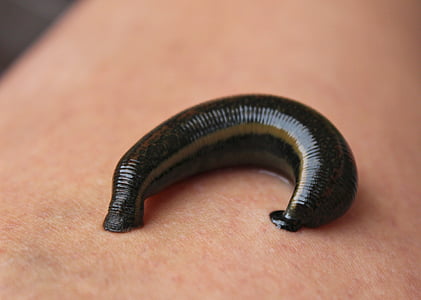 black leech sucking human skin thumbnail