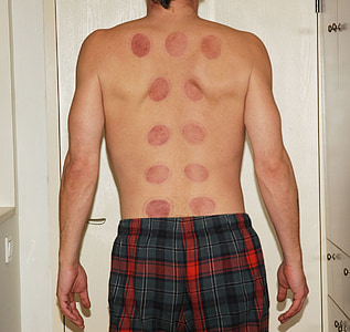 person showing back thumbnail