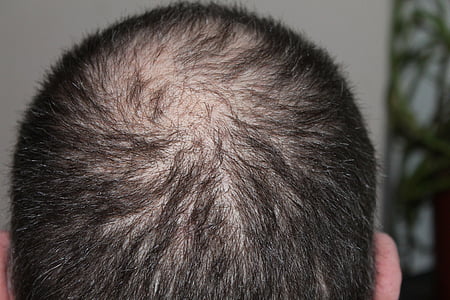 man's black hair thumbnail