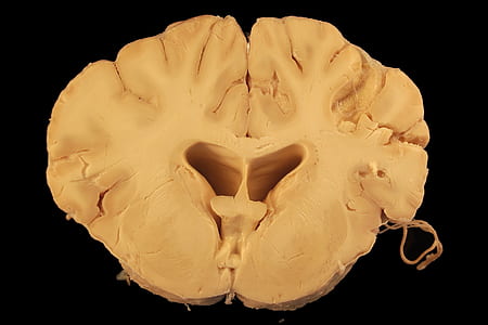 slice huma brain decor thumbnail