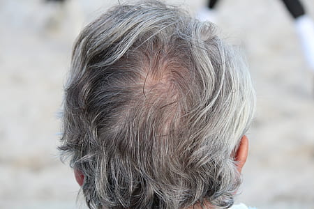 view of person's head thumbnail