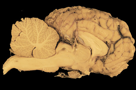 brain illustration thumbnail