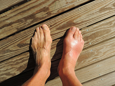 person's foot thumbnail