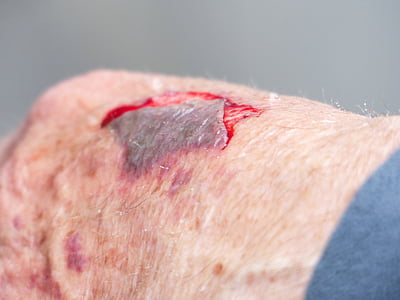 human skin with blood thumbnail