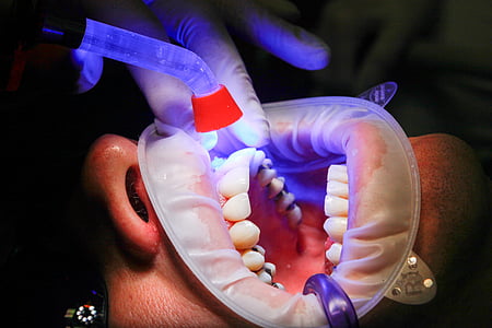person having dental session thumbnail