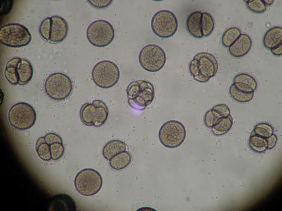 microscopic photo of bacterias thumbnail
