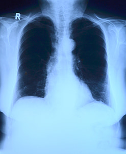 X-ray photo thumbnail