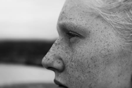 woman face with prickles thumbnail