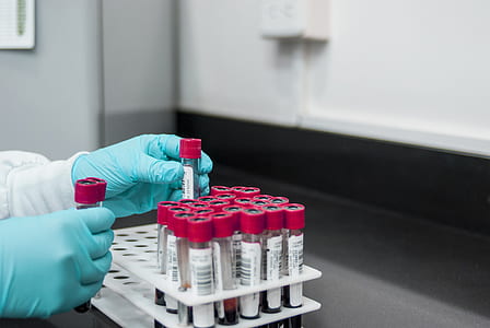 person placing blood test tube on rack thumbnail