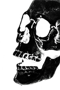 closeup photo of skull x-ray thumbnail