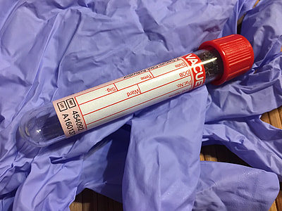 clear glass blood test tube thumbnail