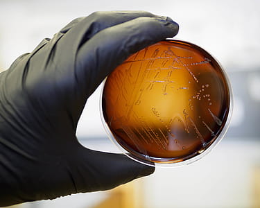 Food safety pathogen Listeria monocytogenes isolated on agar from a food sample. thumbnail