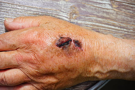 human skin condition thumbnail