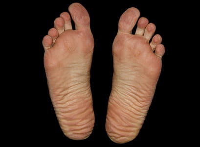 person's foot sole thumbnail