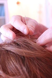 Acupuncture, Alternative Treatment thumbnail