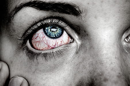 selective color photography of person with bloodshot eyes and blue iris thumbnail