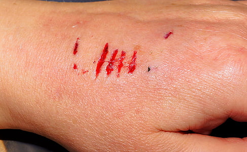 human skin condition thumbnail