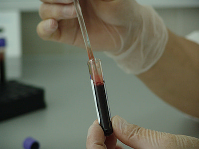 person holding test tube with blood thumbnail