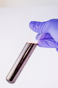 person in purple gloves holding test tube with liquid thumbnail