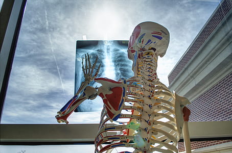 human skeleton holding x-ray paper thumbnail