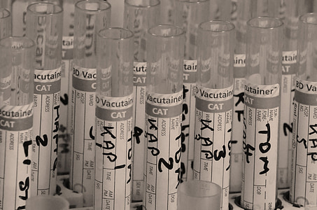 shallow focus photo of clear glass test tubes thumbnail