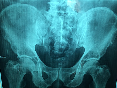 x-ray illustration thumbnail