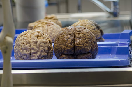 brain on blue tray thumbnail