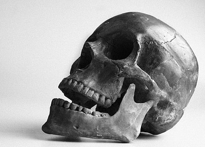 closeup photo of gray human skull thumbnail
