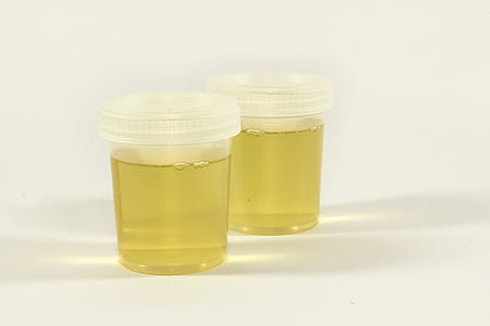 two clear plastic containers filled with yellow liquid thumbnail