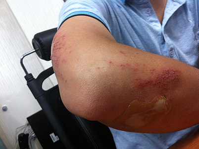 human skin condition thumbnail