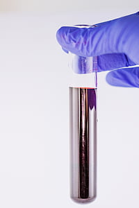 person wearing purple gloves holding text tube thumbnail
