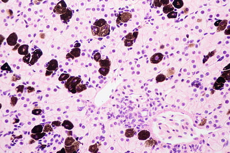 light microscope view of liver cells thumbnail