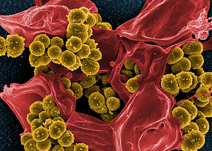 microscopic photograph of bacteria thumbnail