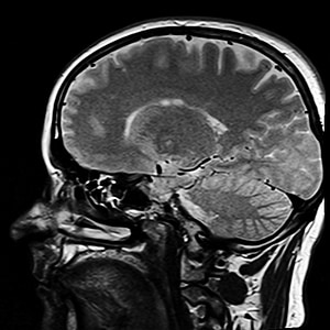 human head X-ray thumbnail