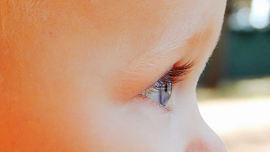 toddler's right eye thumbnail