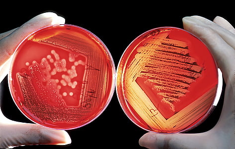 person holding two red bowls thumbnail
