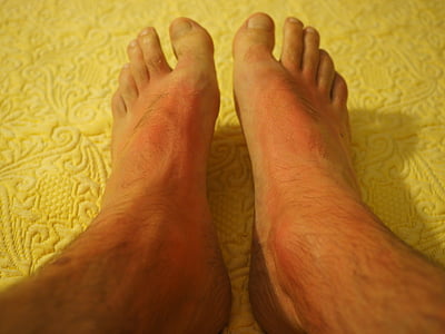 person's feet on white floral textile thumbnail