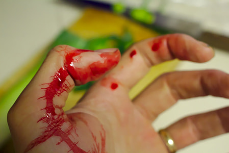 wound hand with blood thumbnail