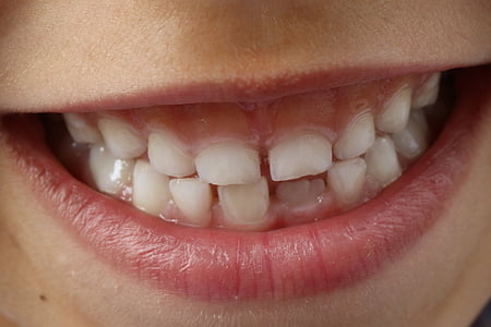 person white teeth thumbnail